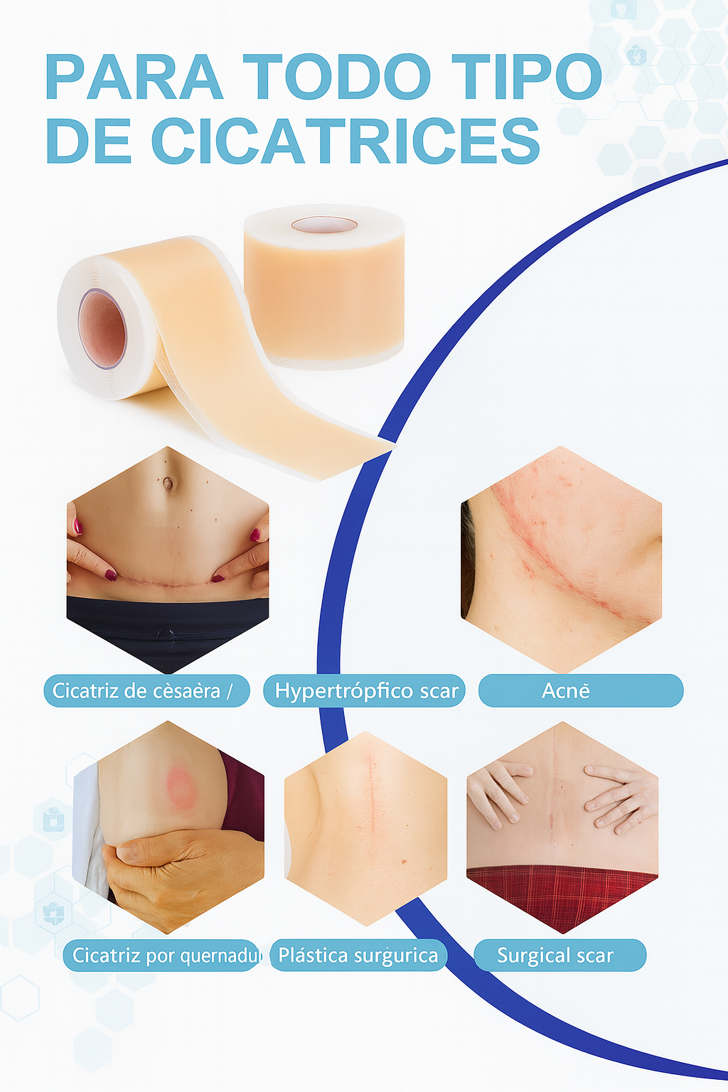 Cinta De Silicona Cicatrices Cirugías Quemaduras Acné