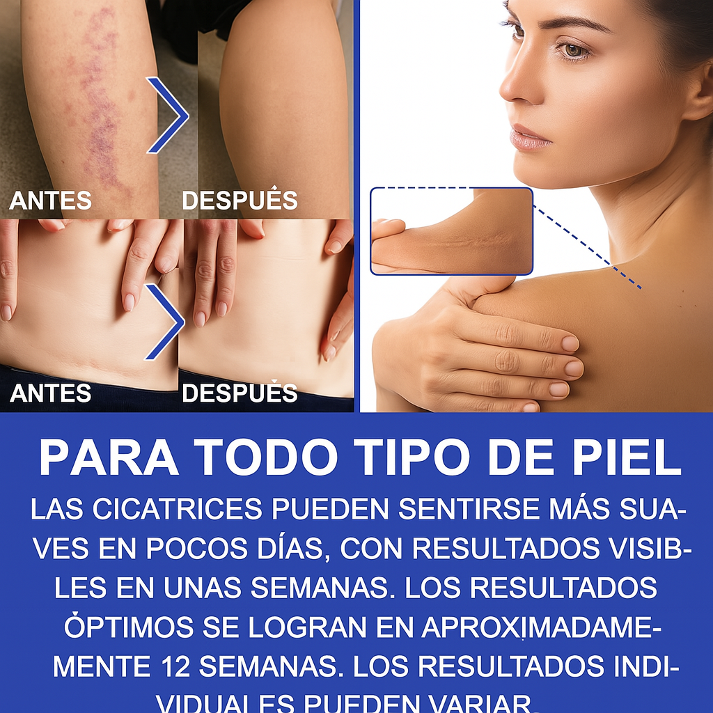 Cinta Autoadhesiva Silicona Remueve Cicatriz 3 Mts Elaimei