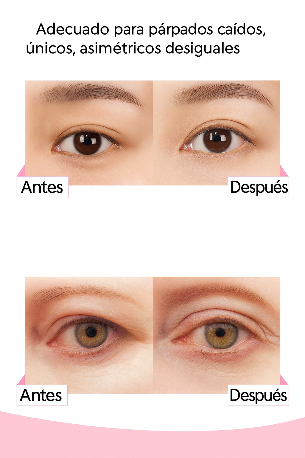 Cinta Parche Para Levantar Parpados Ojos Caidos X 960ud