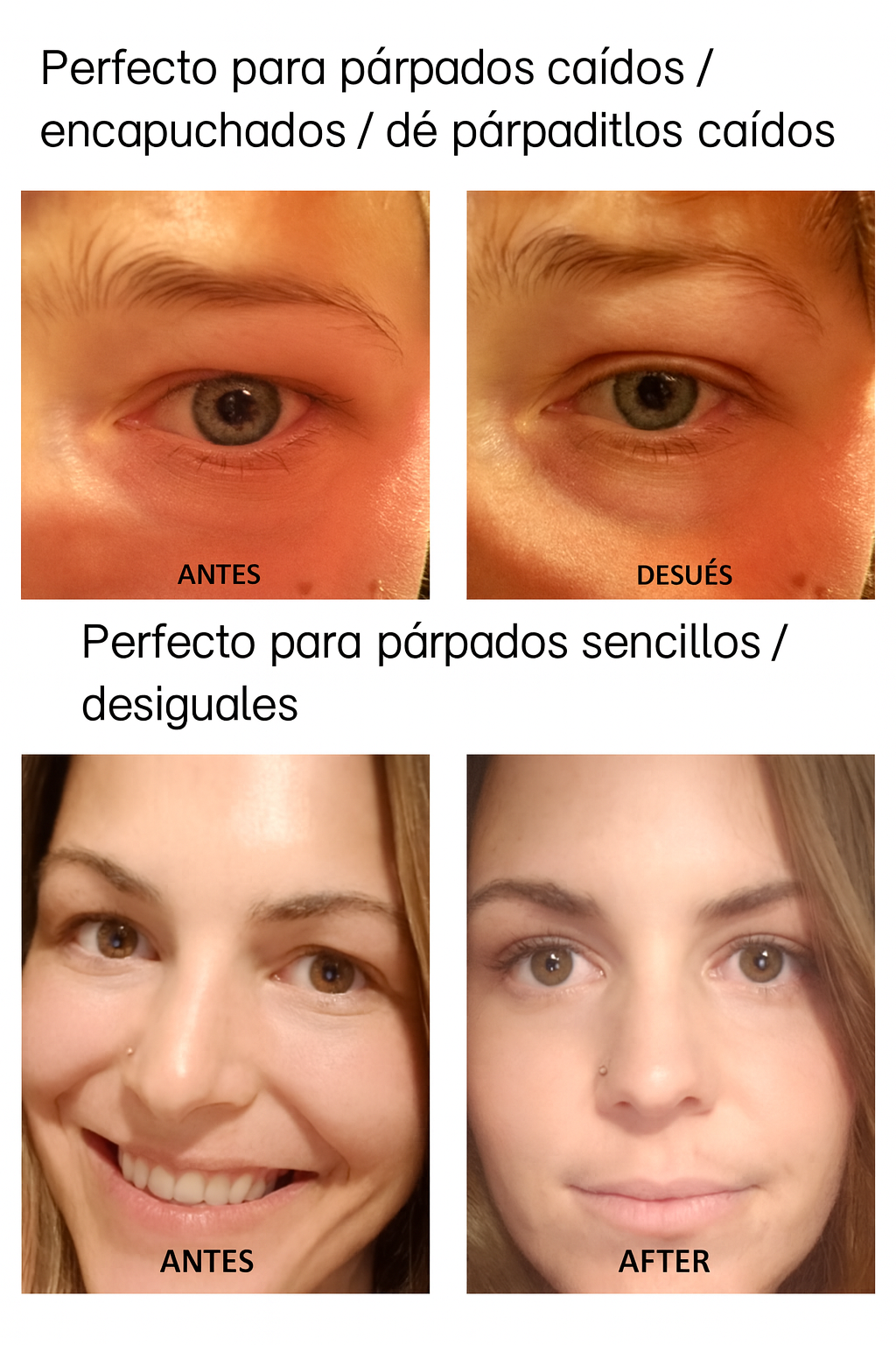 Cinta Parche Para Levantar Parpados Ojos Caidos X 960ud